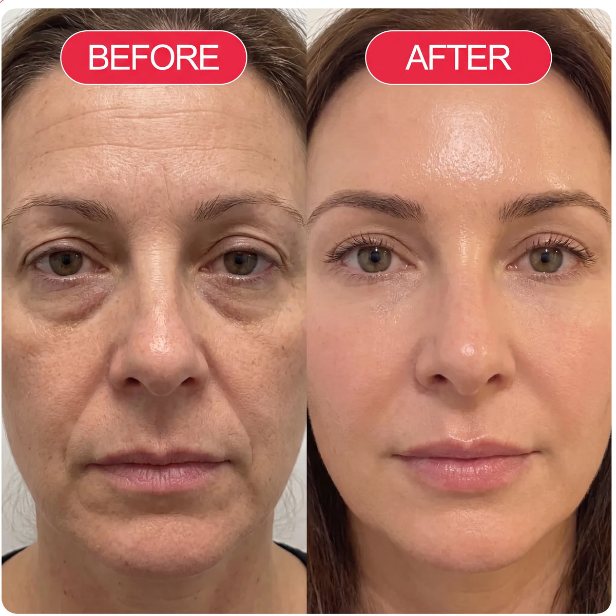 Vivederm™ PDRN Recovery Cream (All-In-One)