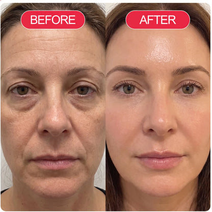 Vivederm™ PDRN Recovery Cream (All-In-One)